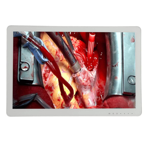 Медичний монітор S3281P 4K 31.5’’ Медичний монітор S3281P 4K 31.5’’