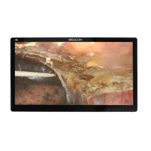 Медичний монітор S3281P 4K 31.5’’ Медичний монітор S3281P 4K 31.5’’