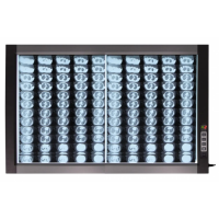 Світлодіодний медичний негатоскоп WL-2D