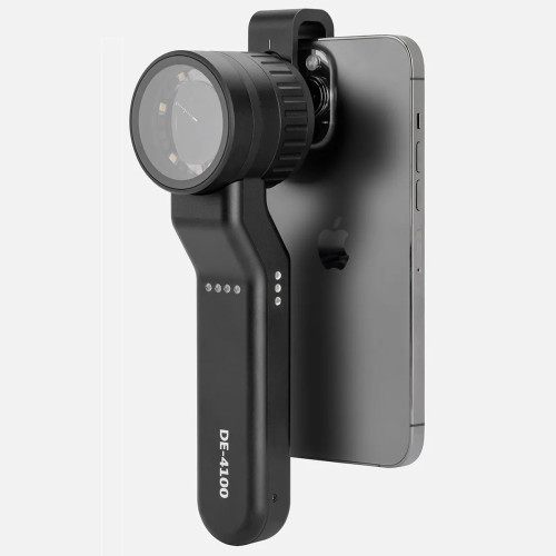 Дерматоскоп INVITA D-41 PRO Дерматоскоп INVITA D-41 PRO