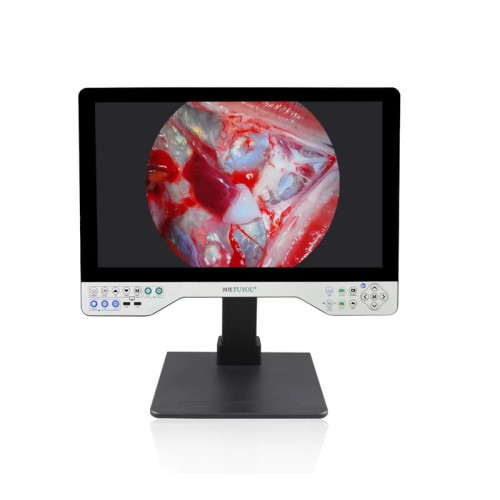 Ендоскопічна відеосистема TUYOU 24LSD1B 1080Р (24 дюйми, жорстка, Все в одному) Ендоскопічна відеосистема TUYOU 24LSD1B 1080Р (24 дюйми, жорстка, Все в одному)